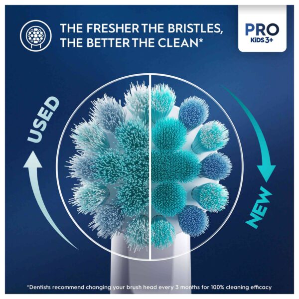 Oral-B Vitality Kids Electric Toothbrush — изображение 3