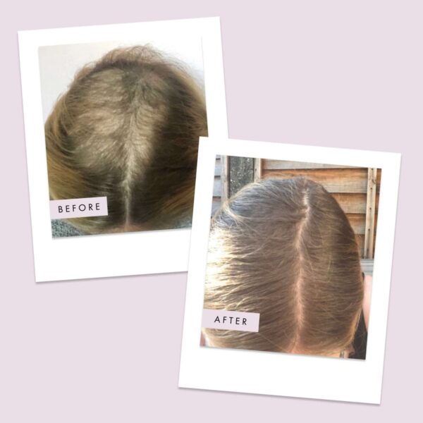 Hair Gain Hair Capsules Duo 2 Month Supply x 120 Capsules — изображение 5